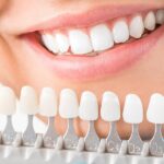 Can Porcelain Veneers Fix Gaps Between Teeth?