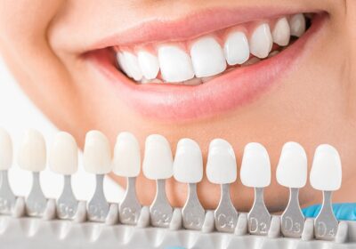 Can Porcelain Veneers Fix Gaps Between Teeth?