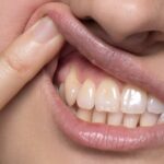 6 Warning Signs of Gingivitis You Shouldn’t Ignore—And How to Protect Your Gums