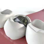 Setting Realistic Expectations for Cosmetic Procedures